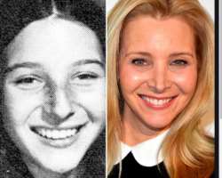 Lisa Kudrow before surgery